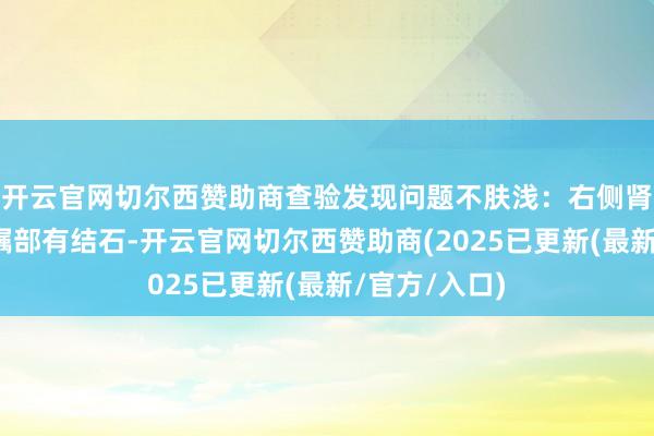 开云官网切尔西赞助商查验发现问题不肤浅：右侧肾盂输尿管叮嘱部有结石-开云官网切尔西赞助商(2025已更新(最新/官方/入口)